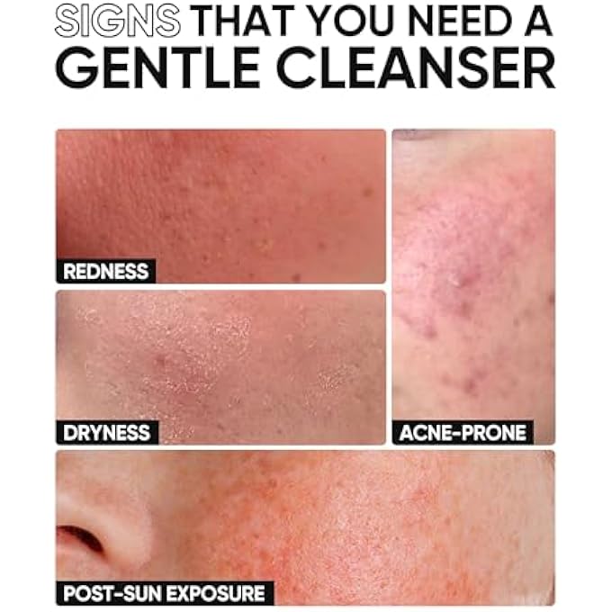 SKINTIFIC منظف وجه 5X سيراميد منخفض الرقم الهيدروجيني 80 جرام للعناية بالبشرة - Image 3